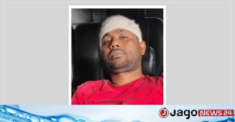 og_1779517436_6a1147fc2af5b