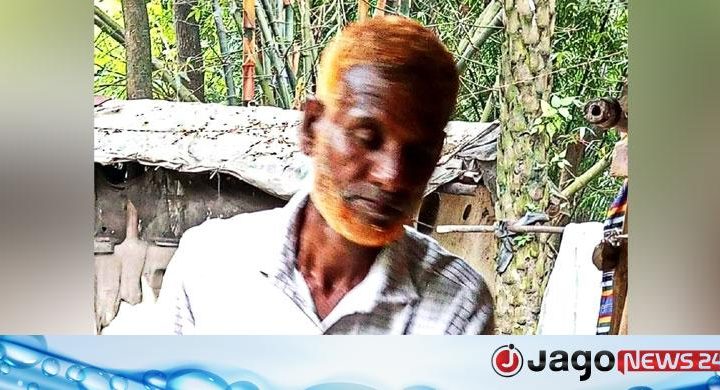 আম খাওয়ার সময় শ্বাসনালীতে আঁটি আটকে প্রাণ গেল কৃষকের