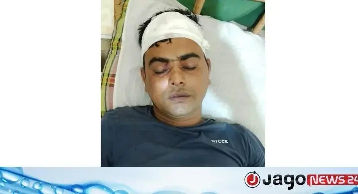 আসামি ধরতে গিয়ে হামলায় এএসআইসহ তিন পুলিশ সদস্য আহত